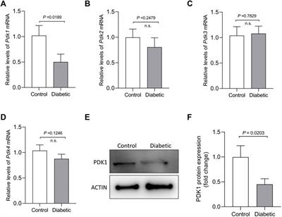 Loss of PDK1 Induces Meiotic Defects in Oocytes From Diabetic Mice